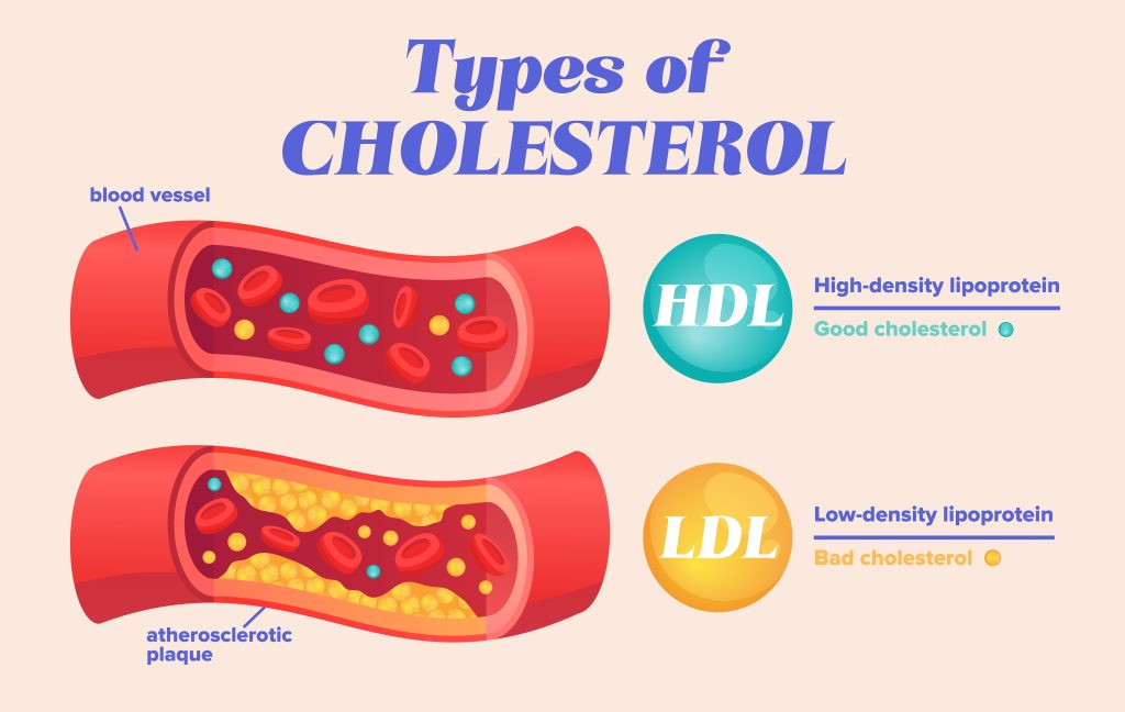 Cholesterol
