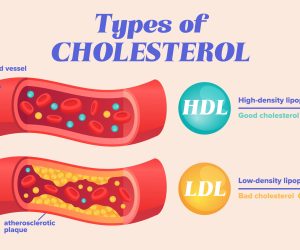 Cholesterol